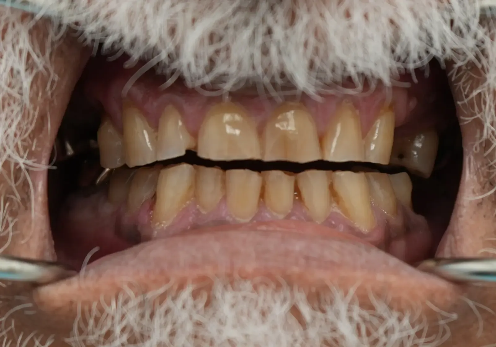 Before dental treatment photo for patient 1