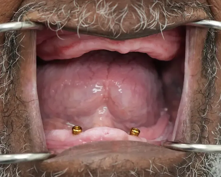 Before dental treatment photo for patient 3